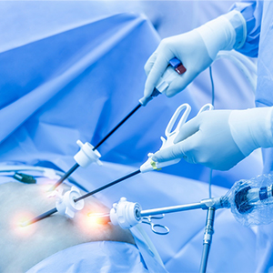 laparoscopic-surgery-vijayawada